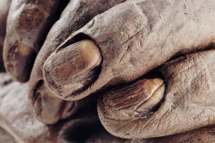 The Mystery of Ireland’s Bog Bodies and the Stories They Still Refuse to Tell